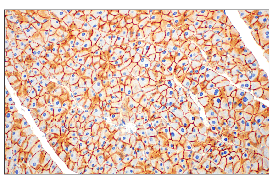 Immunohistochemistry Image 4: E-Cadherin (24E10) Rabbit Monoclonal Antibody (BSA and Azide Free)