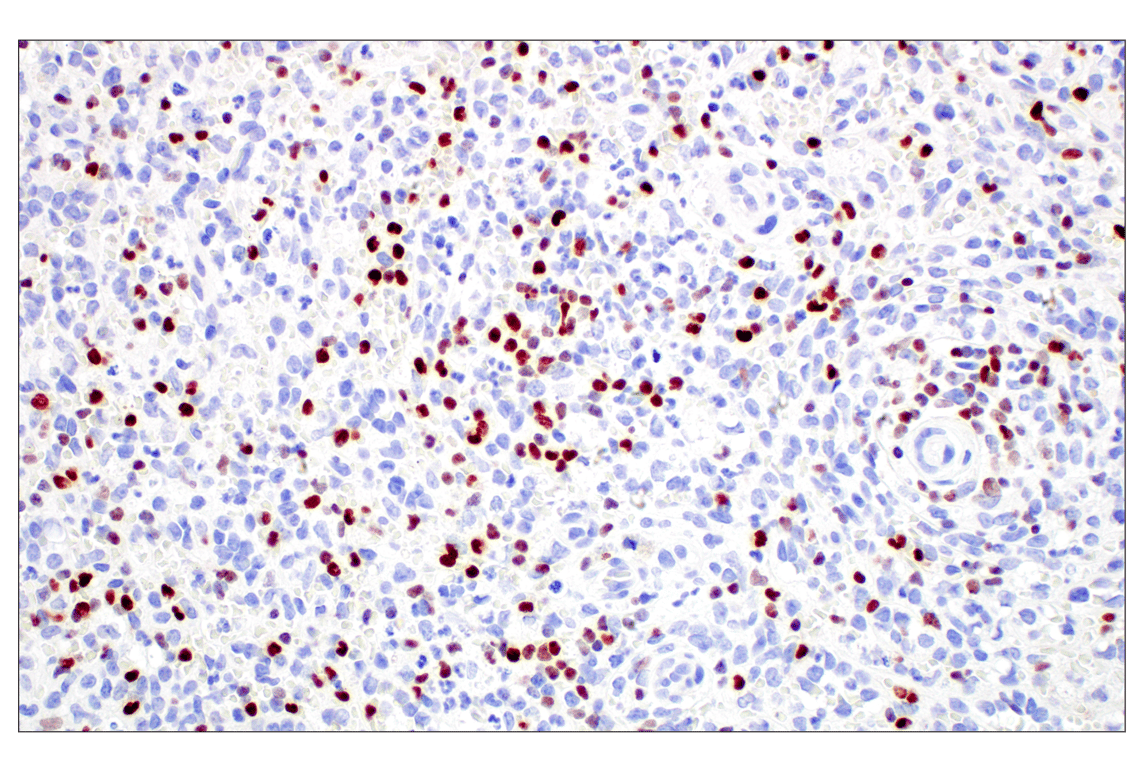 Immunohistochemistry Image 2: T-bet/TBX21 (E4I2K) Rabbit Monoclonal Antibody (BSA and Azide Free)