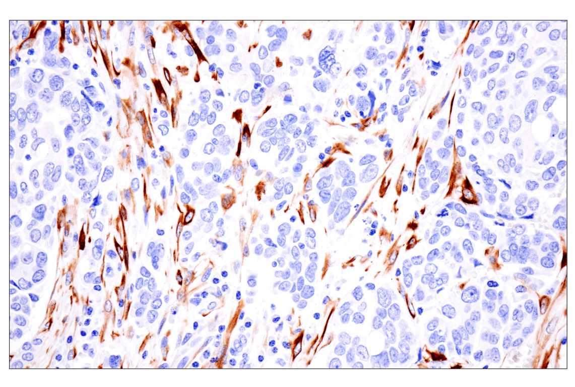 Immunohistochemistry Image 6: Desmin (F5V4I) Rabbit Monoclonal Antibody (BSA and Azide Free)