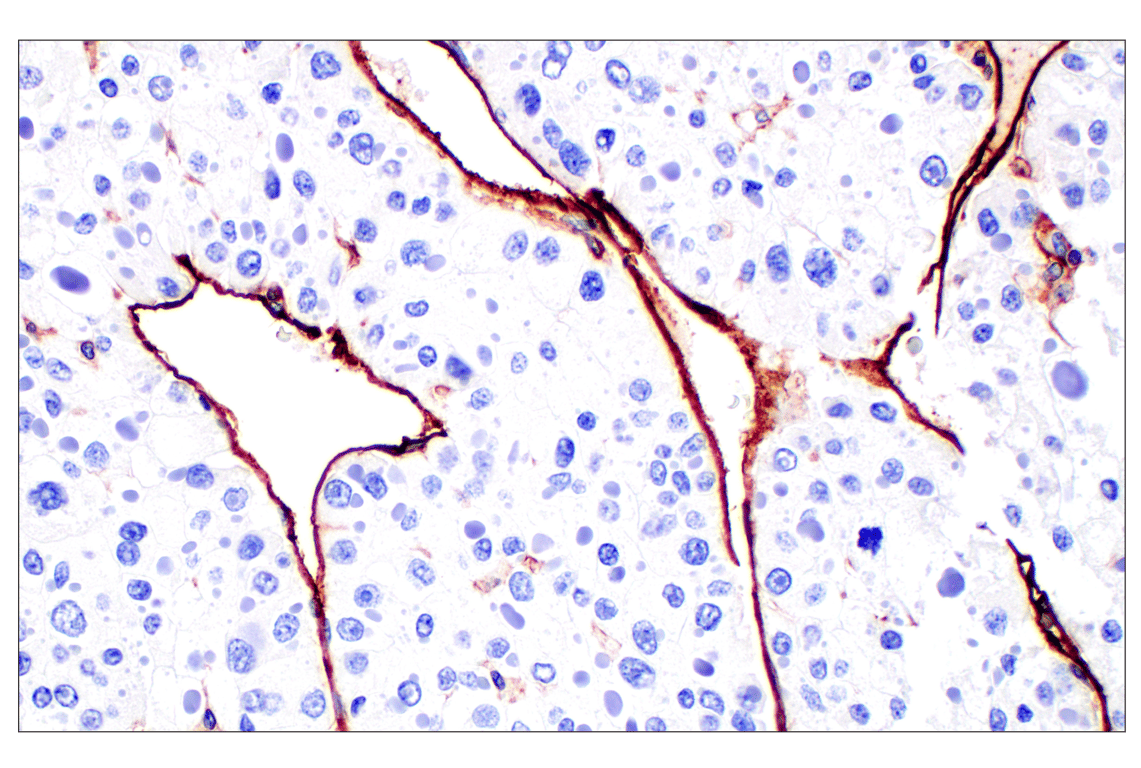 Immunohistochemistry Image 7: CD31 (PECAM-1) (F8M3S) Rabbit Monoclonal Antibody