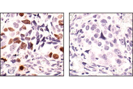 Immunohistochemistry Image 3: Phospho-Histone H3 (Ser10) Antibody