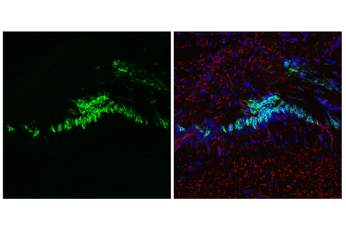 Immunofluorescence Image 2: Doublecortin (F6K9E) Rabbit Monoclonal Antibody (BSA and Azide Free)