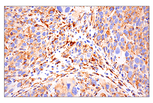 Immunohistochemistry Image 3: CD68 (E3O7V) Rabbit mAb