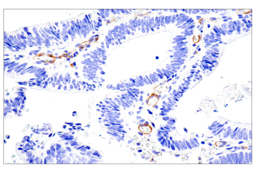 Immunohistochemistry Image 1: NG2/CSPG4 (E3B3G) Rabbit Monoclonal Antibody