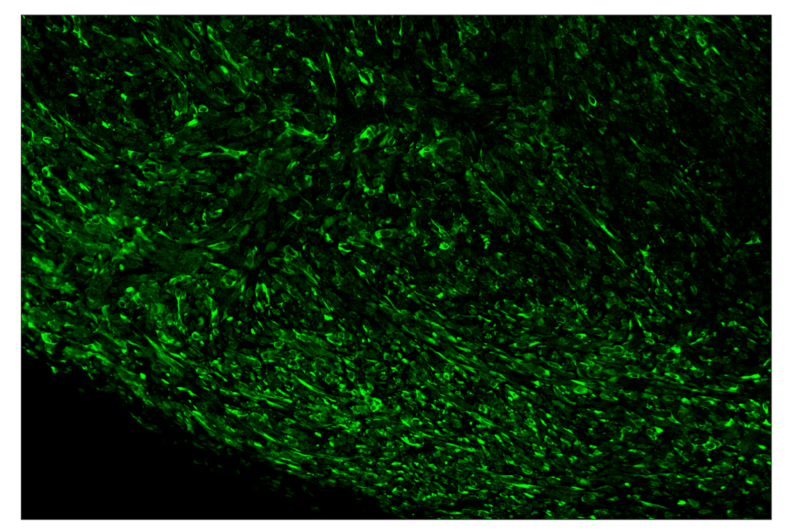 Immunohistochemistry Image 1: Phospho-S6 Ribosomal Protein (Ser235/236) (D57.2.2E) & CO-0107-750 SignalStar<sup>™</sup> Oligo-Antibody Pair