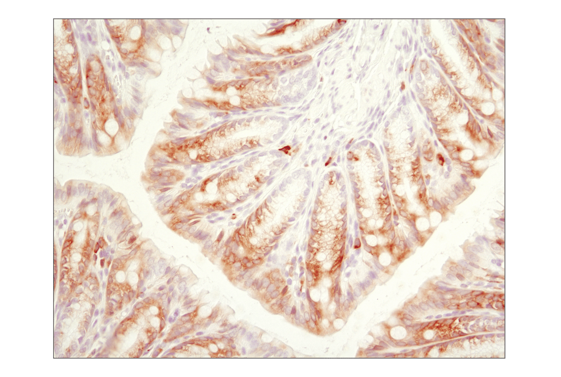 Immunohistochemistry Image 7: Phospho-S6 Ribosomal Protein (Ser240/244) (D68F8) Rabbit Monoclonal Antibody