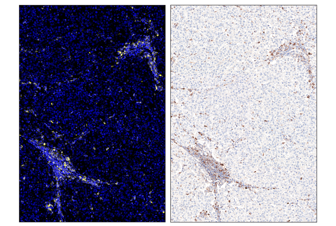 Immunohistochemistry Image 6: Phospho-SLP-76 (Ser376) (E3G9U) & CO-0018-488 SignalStar<sup>™</sup> Oligo-Antibody Pair