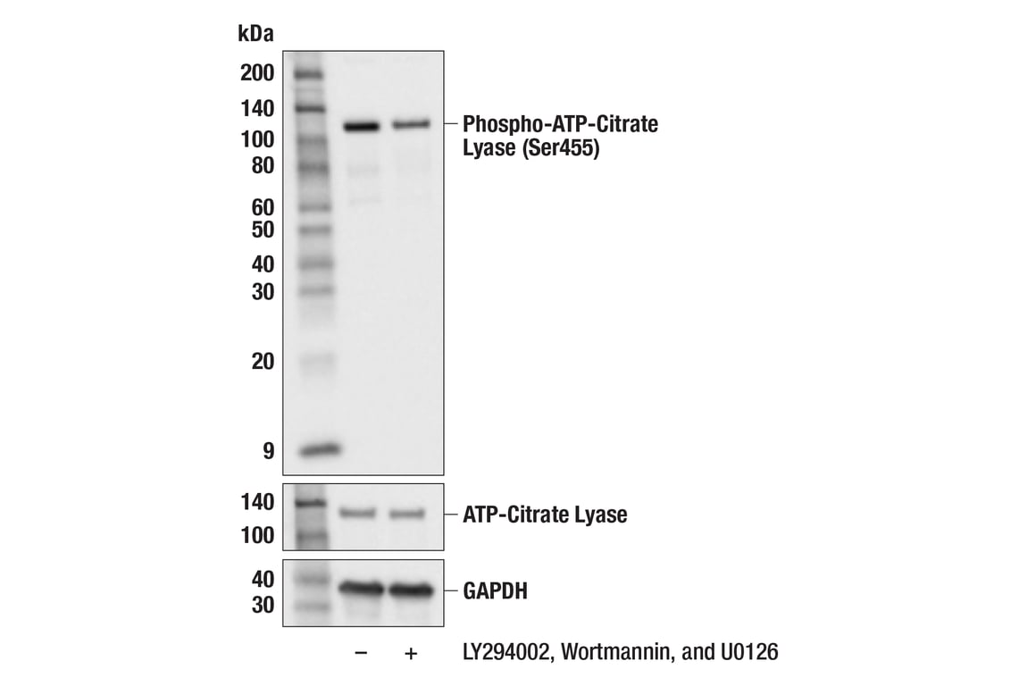 Western Blotting Image 3: Phospho-ATP-Citrate Lyase (Ser455) (F4T8R) Rabbit Monoclonal Antibody