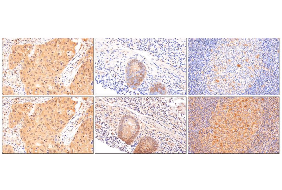 Immunohistochemistry Image 11: Phospho-Stat3 (Ser727) (D4X3C) Rabbit Monoclonal Antibody