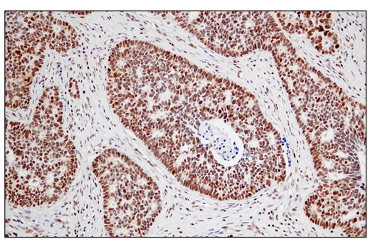 Immunohistochemistry Image 3: JMJD6 (D3O3N) Rabbit Monoclonal Antibody