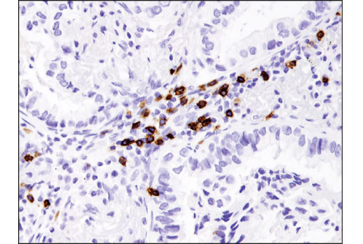 Immunohistochemistry Image 2: CD8 alpha (D8A8Y) Rabbit Monoclonal Antibody
