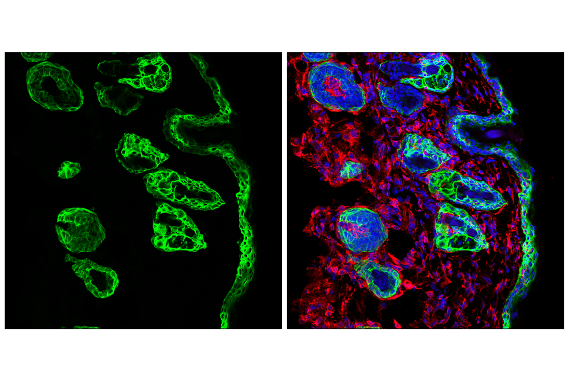 Immunofluorescence Image 1: Keratin 14 (E7W6V) Rabbit Monoclonal Antibody