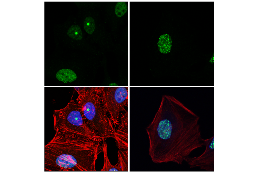 Immunofluorescence Image 2: 53BP1 (E7N5D) XP<sup>®</sup> Rabbit mAb