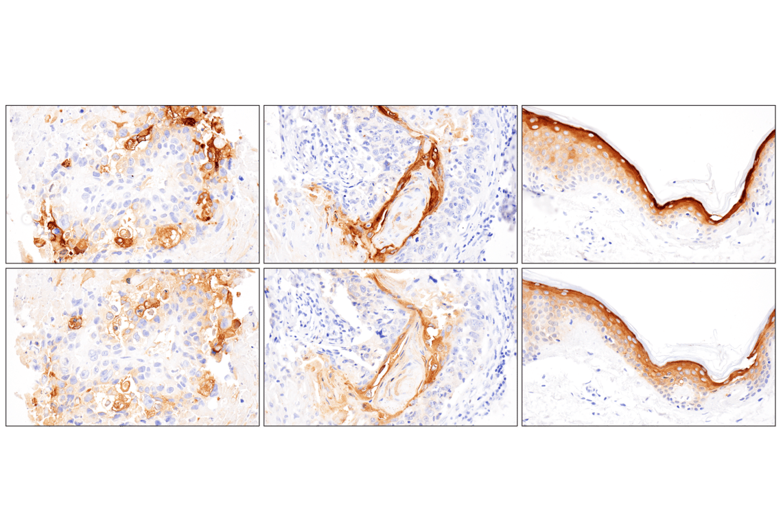 Immunohistochemistry Image 8: Involucrin (F9C3C) Rabbit Monoclonal Antibody
