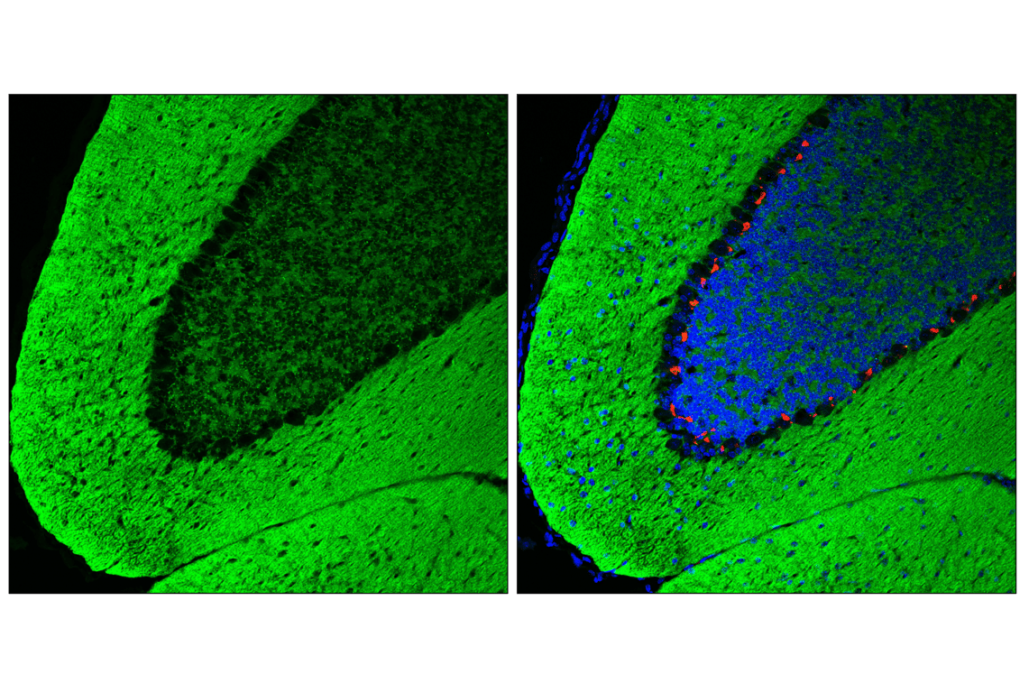 Immunofluorescence Image 2: SNAP25 (F5Z2D) Rabbit Monoclonal Antibody