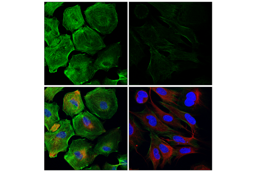 Immunofluorescence Image 1: Myosin IIa (E7Y9O) Rabbit Monoclonal Antibody