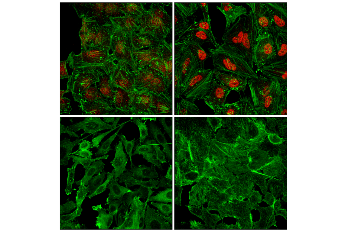 Immunofluorescence Image 1: Stat3 (124H6) Mouse Monoclonal Antibody
