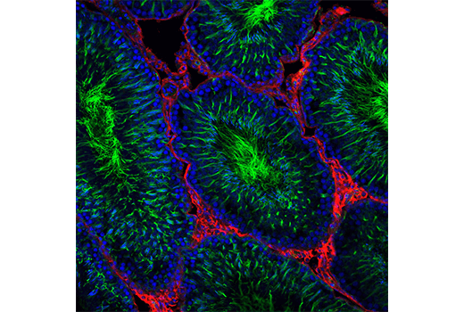 Immunofluorescence Image 1: Acetyl-alpha-Tubulin (Lys40) (D20G3) Rabbit Monoclonal Antibody