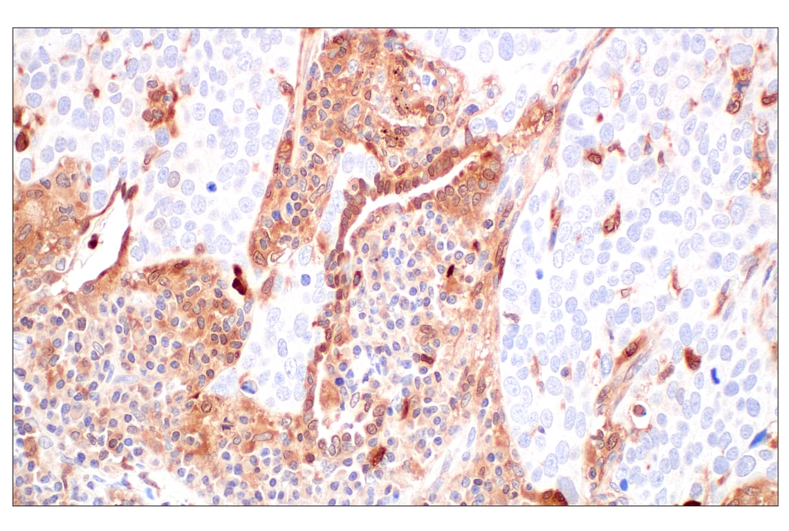 Immunohistochemistry Image 2: SerpinB1 (E4W7B) Rabbit Monoclonal Antibody (BSA and Azide Free)