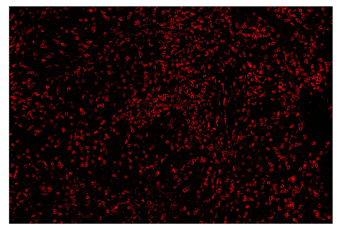 Immunohistochemistry Image 4: CD3ε (D7A6E<sup>™</sup>) & CO-0001-647 SignalStar<sup>™</sup> Oligo-Antibody Pair