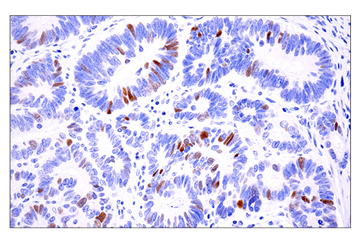 Immunohistochemistry Image 2: Phospho-Chk2 (Thr68) (E8Q1A) Rabbit Monoclonal Antibody (BSA and Azide Free)