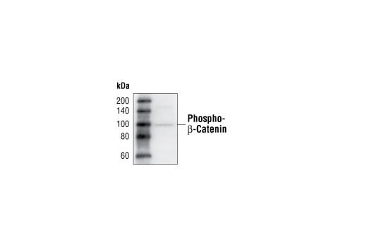 undefined Image 13: beta-Catenin Antibody Sampler Kit