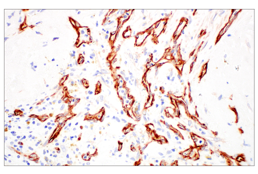 Immunohistochemistry Image 2: Nestin (E4O9E) Rabbit Monoclonal Antibody