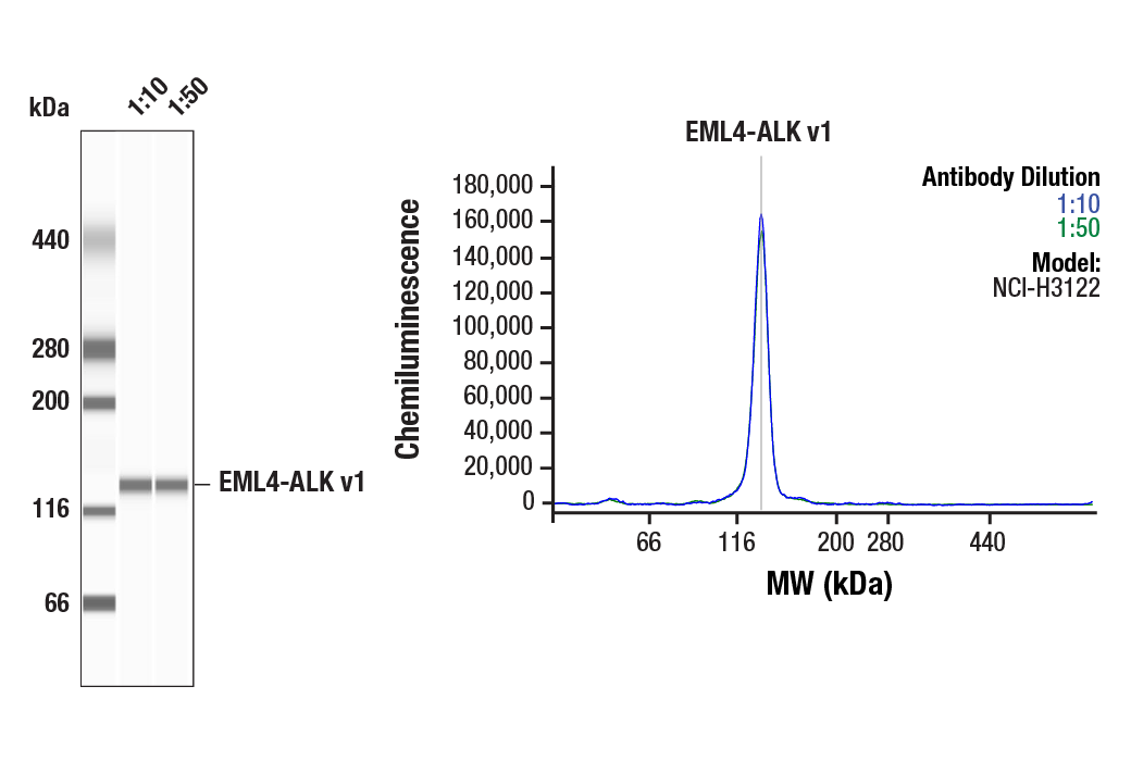 Western Blotting Image 1: ALK (D5F3) Rabbit Monoclonal Antibody