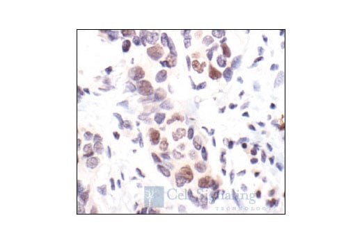 Immunohistochemistry Image 1: Rb (4H1) Mouse Monoclonal Antibody