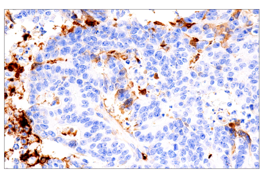Immunohistochemistry Image 1: Fibrinogen gamma chain (E1U3Z) XP<sup>®</sup> Rabbit mAb (BSA and Azide Free)