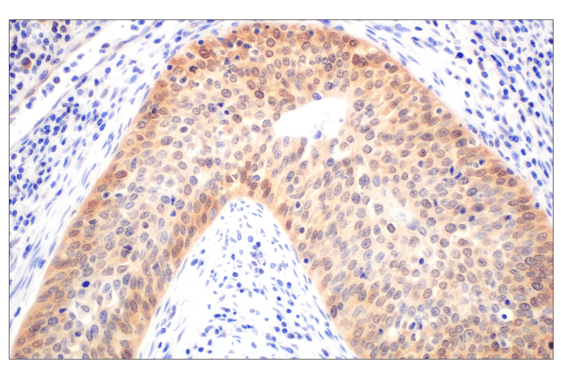 Immunohistochemistry Image 2: Galectin-8/LGALS8 (F9O3T) Rabbit Monoclonal Antibody