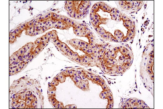 Immunohistochemistry Image 3: Bak (D4E4) Rabbit Monoclonal Antibody (BSA and Azide Free)