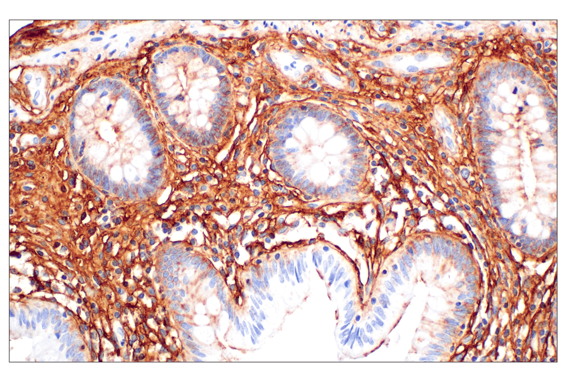 Immunohistochemistry Image 6: Hyaluronan Complete Tissue Staining Kit (HRP)