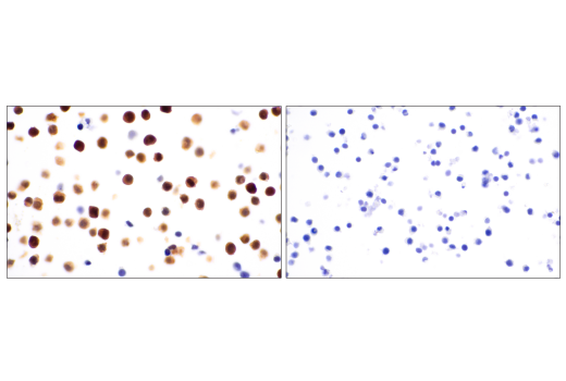 undefined Image 20: Mouse Reactive Inflammasome Antibody Sampler Kit