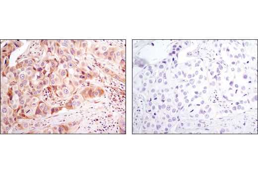 undefined Image 24: Pro-Apoptosis Bcl-2 Family Antibody Sampler Kit II