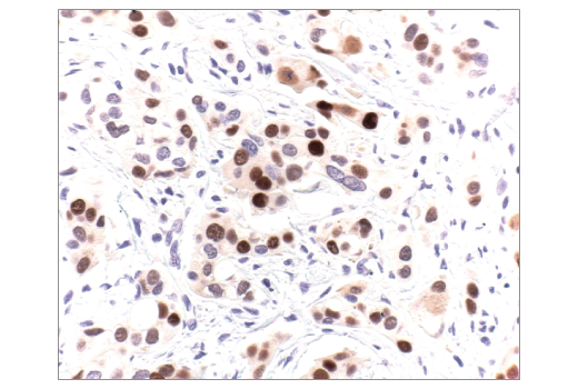 Immunohistochemistry Image 1: p53 (7F5) Rabbit Monoclonal Antibody (BSA and Azide Free)