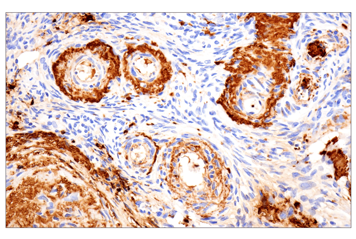 Immunohistochemistry Image 11: Vitronectin (F8D3L) Rabbit Monoclonal Antibody