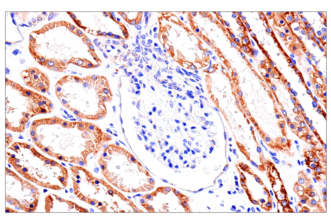 Immunohistochemistry Image 14: SLC25A1 (E7B2B) Rabbit Monoclonal Antibody