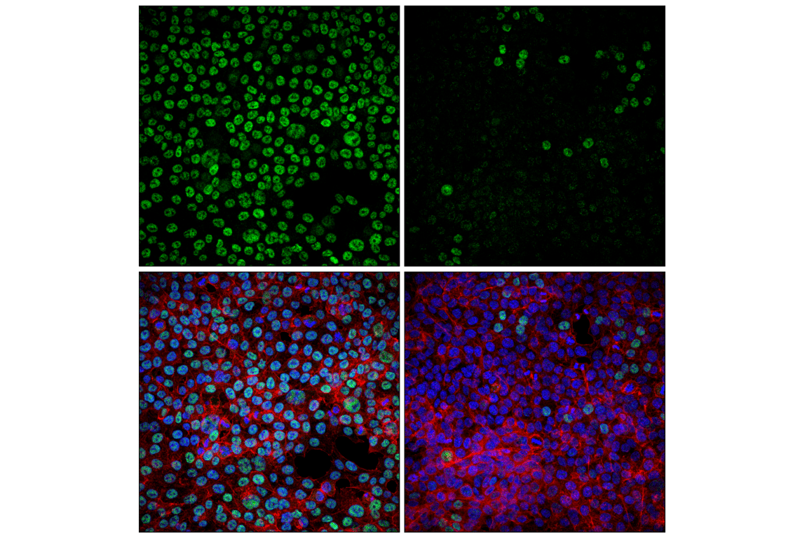 Immunofluorescence Image 1: USP22 (F4M4V) Rabbit Monoclonal Antibody