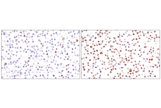 Immunohistochemistry Image 11: HIF-1 alpha (E1V6A) Rabbit Monoclonal Antibody (BSA and Azide Free)