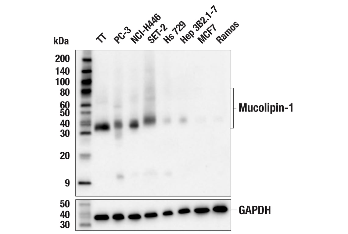 Western Blotting Image 1: Mucolipin-1 (F8F9Q) Rabbit mAb