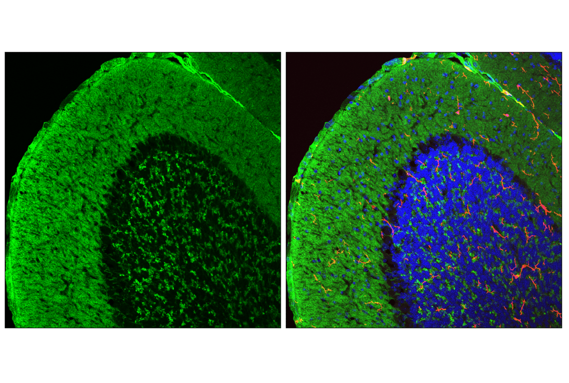 Immunofluorescence Image 1: VGLUT1 (E9D2B) Mouse Monoclonal Antibody