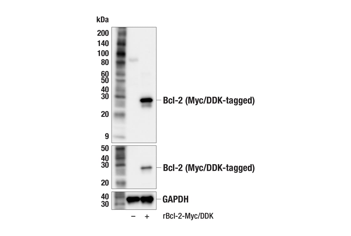 Western Blotting Image 2: Bcl-2 (F9V5R) Rabbit Monoclonal Antibody