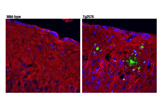 Immunofluorescence Image 1: beta-Amyloid (pE3 Peptide) (D5N5H) Rabbit Monoclonal Antibody (BSA and Azide Free)