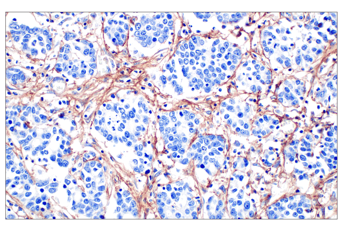 Immunohistochemistry Image 1: COL6A1 (E9U3B) Rabbit Monoclonal Antibody (BSA and Azide Free)
