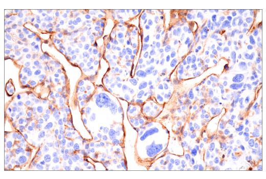 Immunohistochemistry Image 2: CD38 (E9F5A) Rabbit Monoclonal Antibody