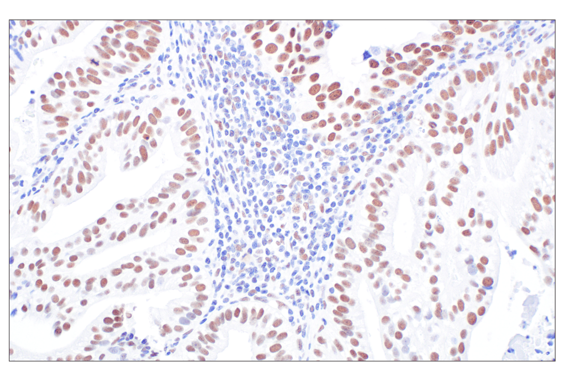Immunohistochemistry Image 2: HDAC2 (3F3) Mouse Monoclonal Antibody