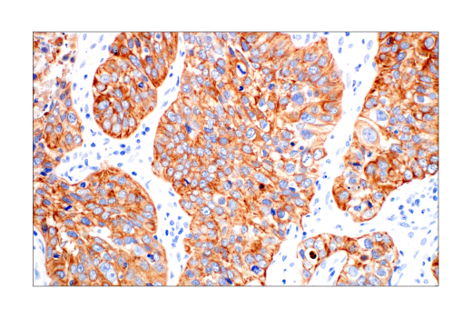 Immunohistochemistry Image 4: Pan-Keratin (AE1/AE3) Mouse Monoclonal Antibody