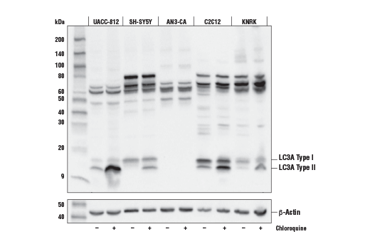 Western Blotting Image 2: LC3A (E5D5M) Rabbit Monoclonal Antibody