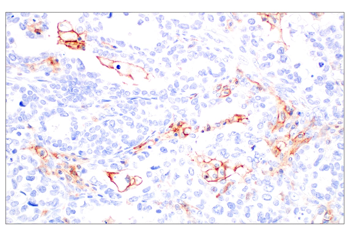 Immunohistochemistry Image 8: CD11b/ITGAM (E3J2F) Rabbit Monoclonal Antibody